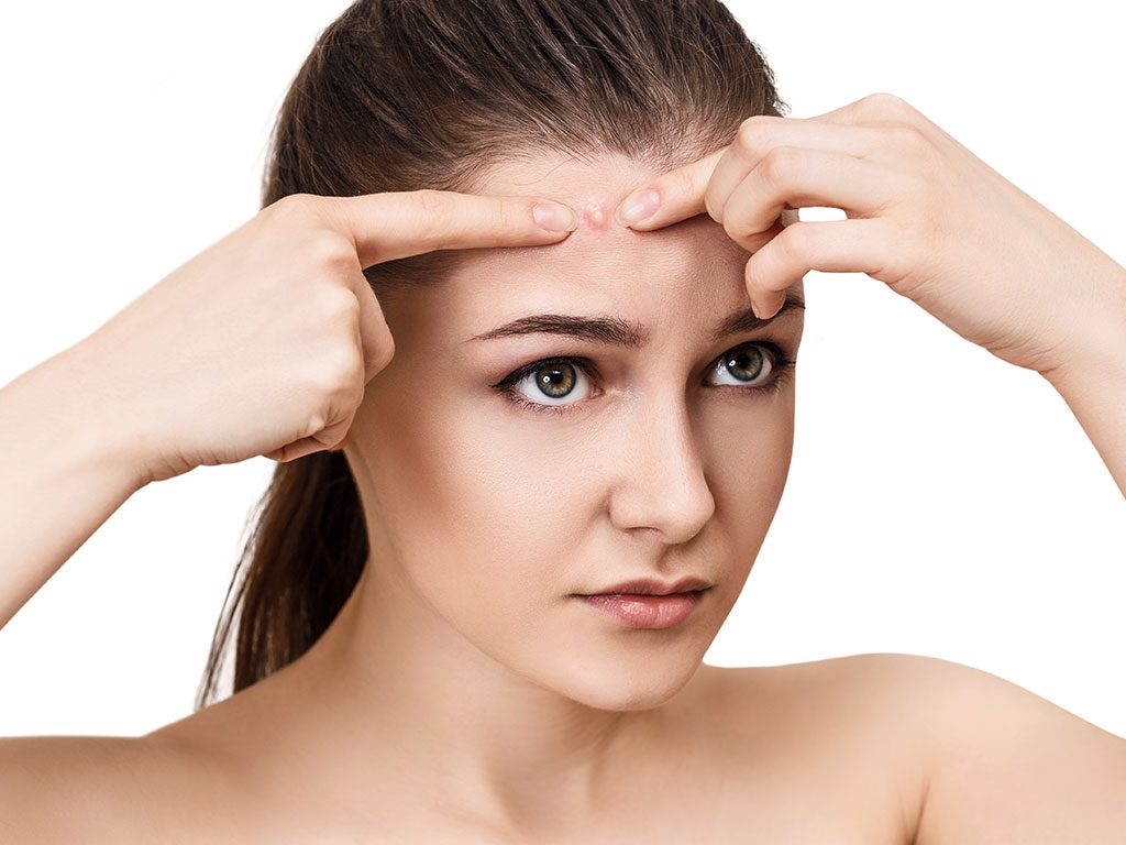 sivilce lekelerinden kurtulma yolları 1